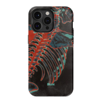 Bone Shredder iPhone Case